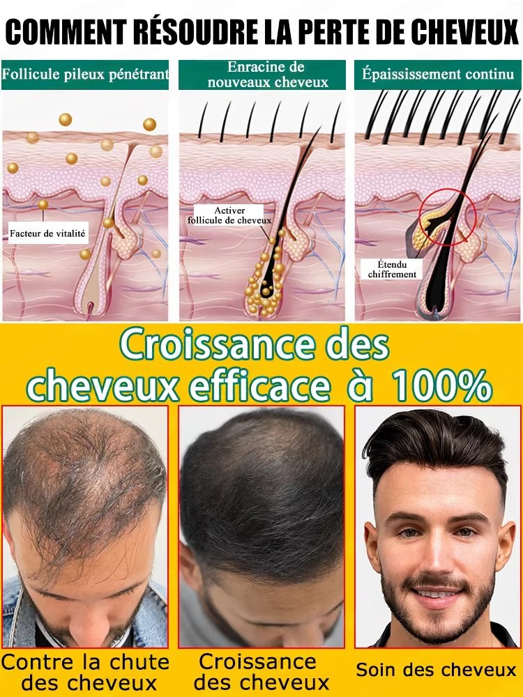 Natural Ginger Hair Care Essen - Hair Care For Hair Fall ulasan dan harga