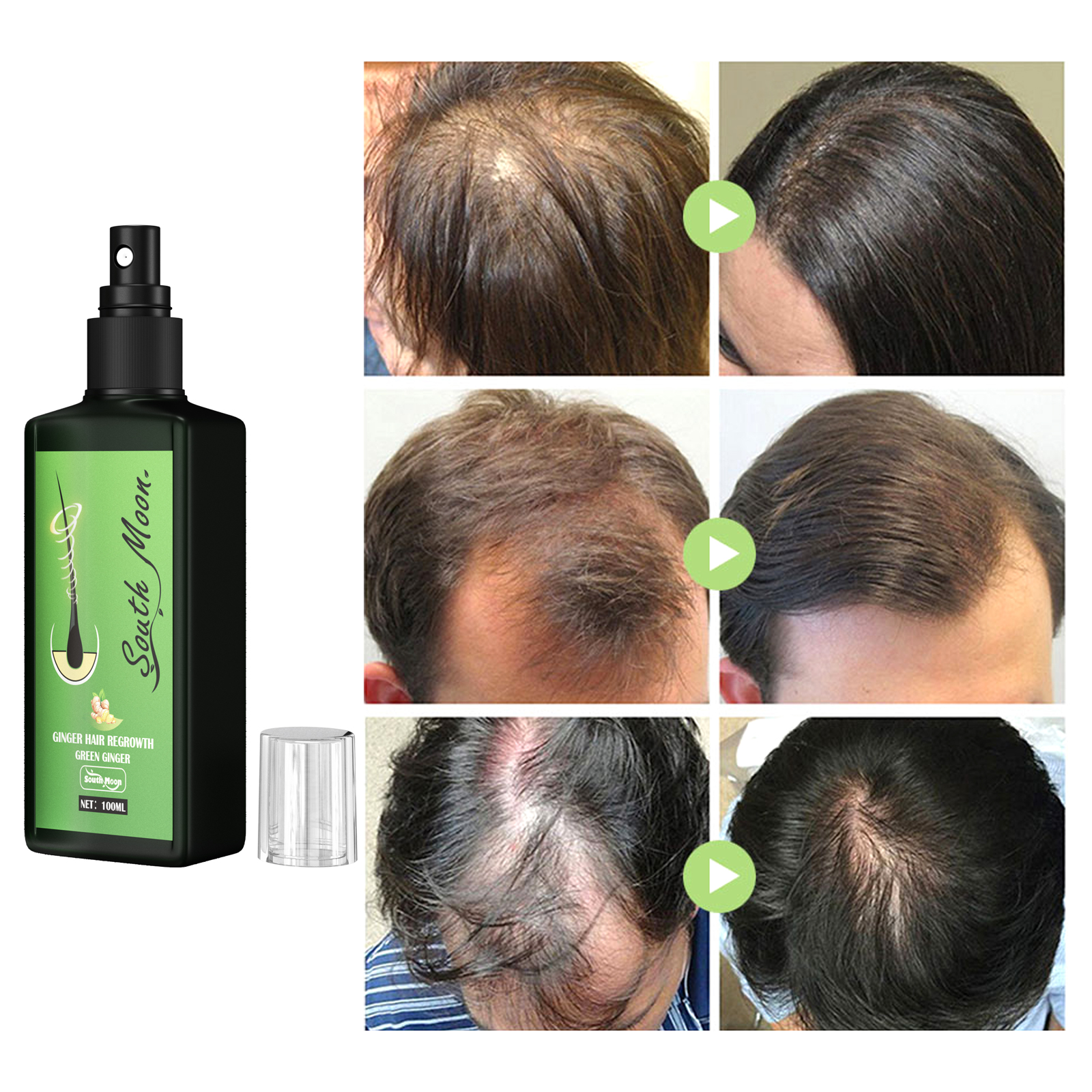 Ginger Hair Density Serum Spra - Hair Care For Hair Fall ulasan dan harga