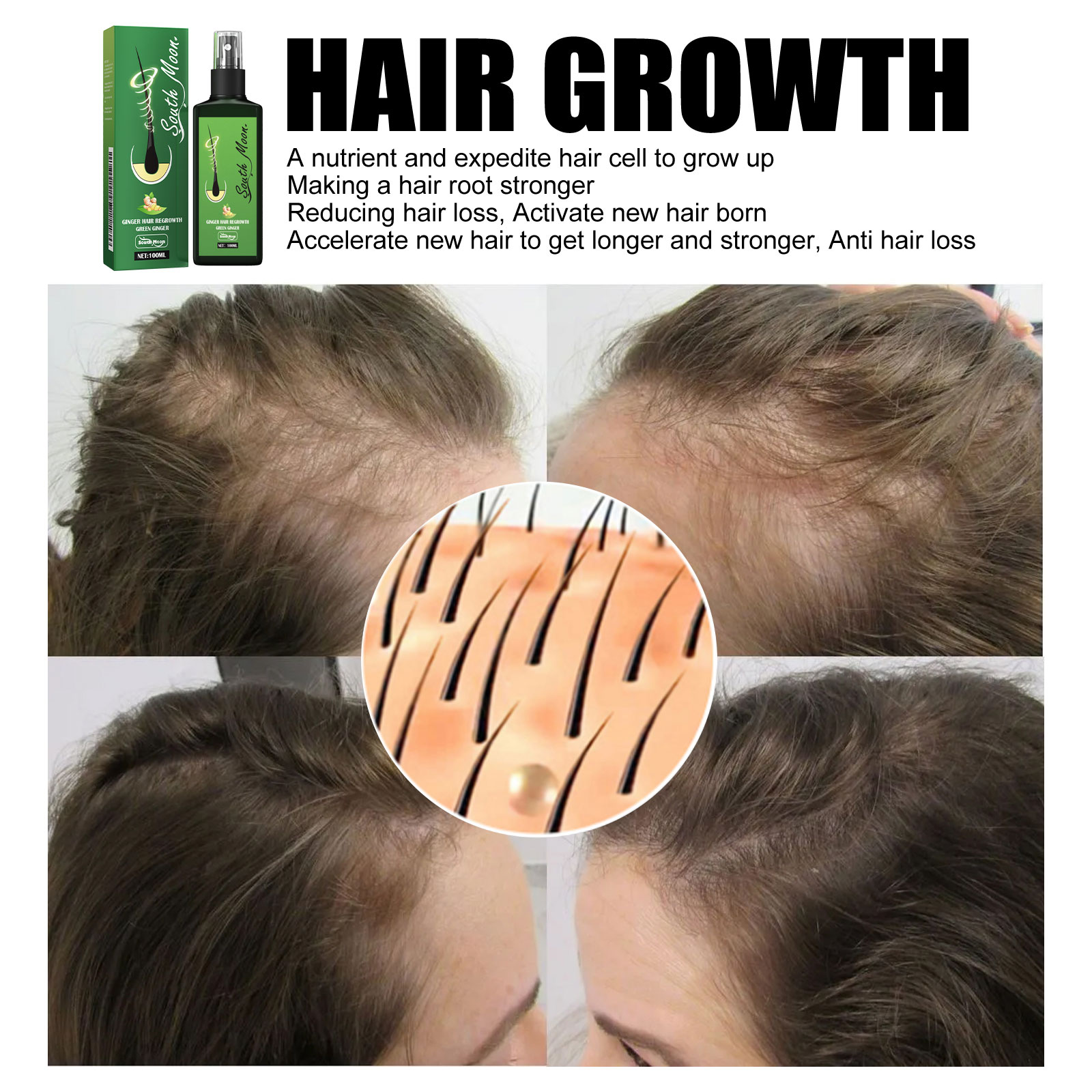 Ginger Hair Density Serum Spra - Hair Care For Hair Fall ulasan dan harga