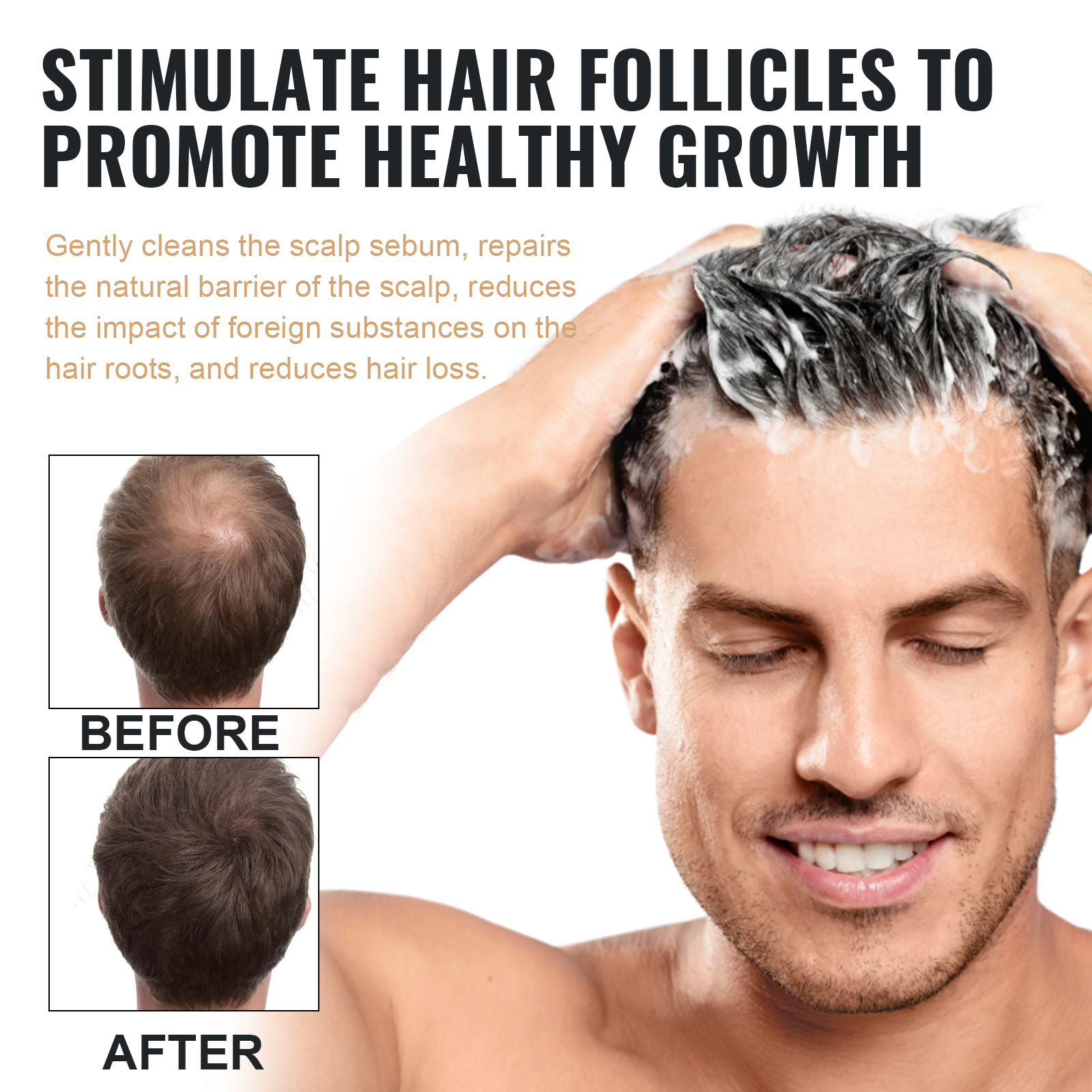 EELHOE 100ml Dense Hair Shampo - Hair Care For Hair Fall ulasan dan harga